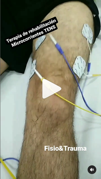 Terapia Rehabilitación Microcorrientes TENS FisioTraumaSalud.com